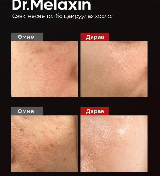 Астаксантин — Байгалийн хамгийн хүчтэй антиоксидант