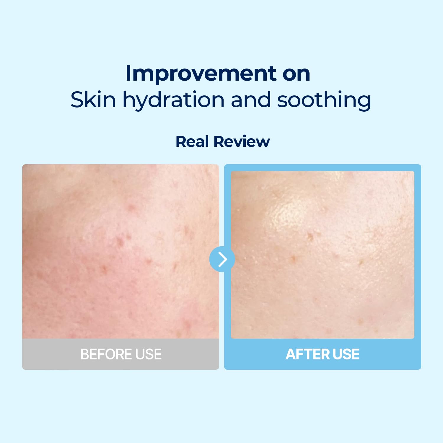 DIVE-IN Low Molecular Hyaluronic Acid  Multi Pad 80ea
