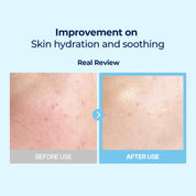DIVE-IN Low Molecular Hyaluronic Acid  Multi Pad 80ea