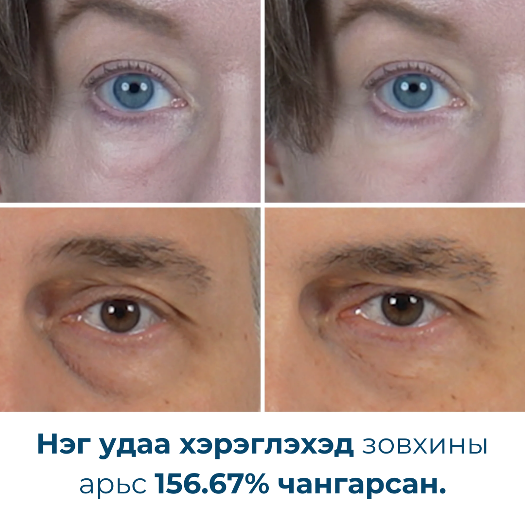 Eyephalt Eyecream for Eyebags 10ml