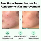AHA BHA PHA 30 Days Miracle Foam