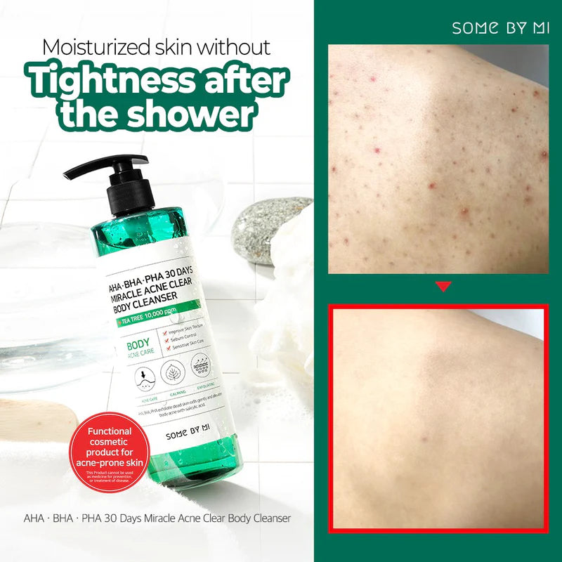 AHA BHA PHA 30 Days Miracle Clear Body Cleanser