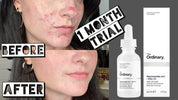 Niacinamide 10% + Zinc 1%