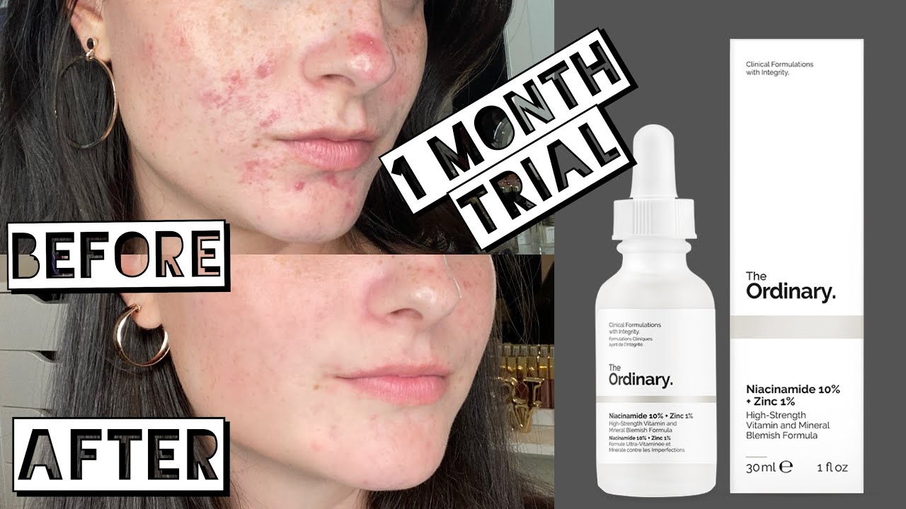 Niacinamide 10% + Zinc 1%