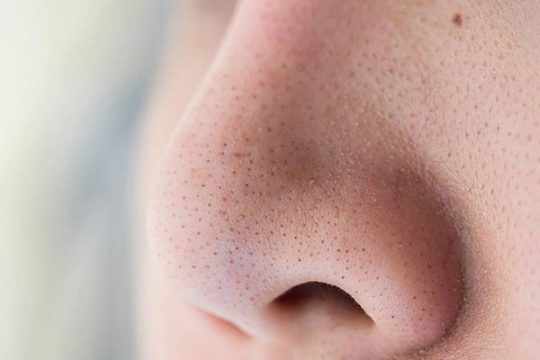 Хар батга, цагаан батга