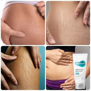 Stretch Mark Safe Cream