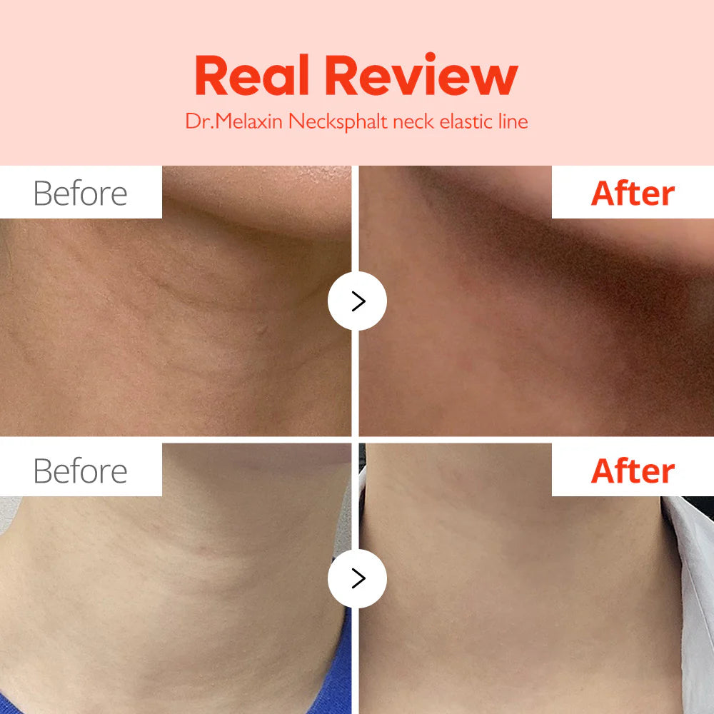 NECK_cream_02.webp