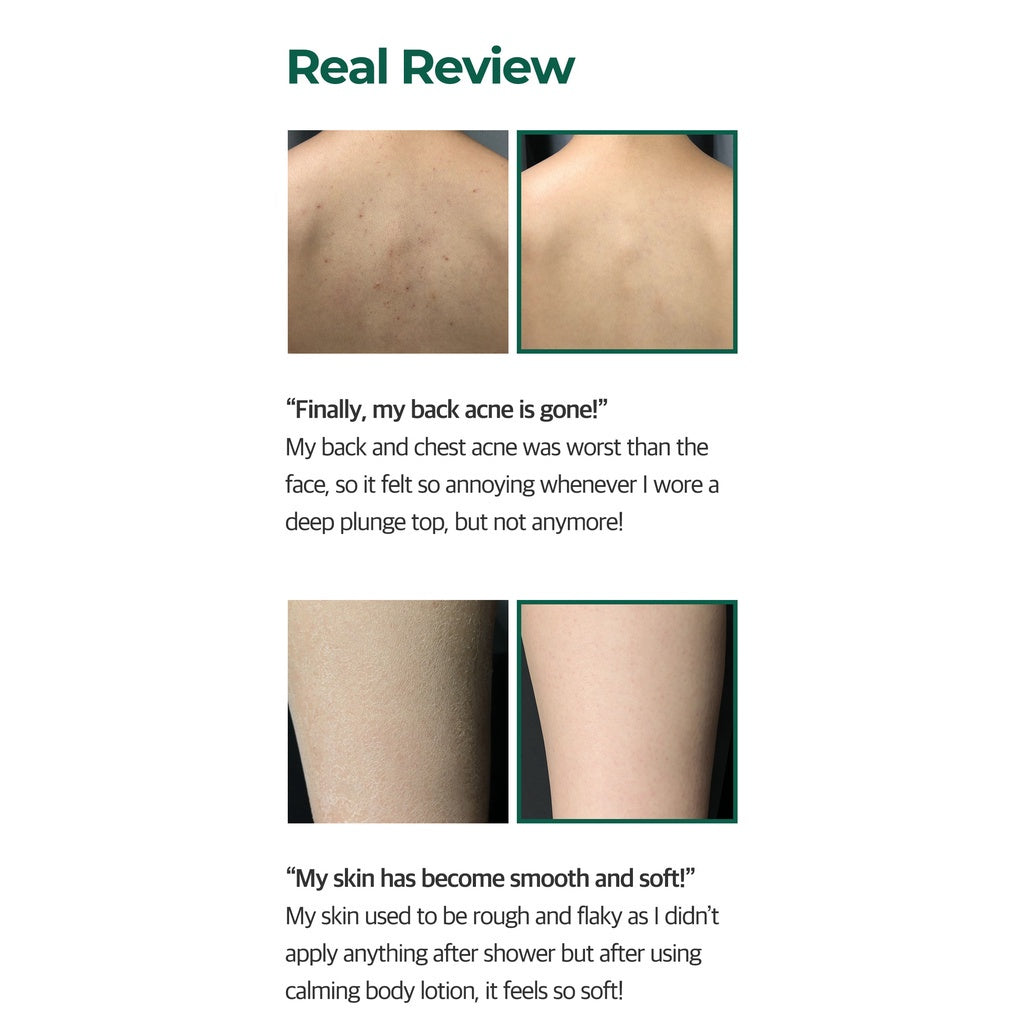 AHA BHA PHA Miracle Calming Body Lotion