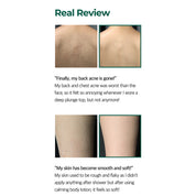 AHA BHA PHA Miracle Calming Body Lotion