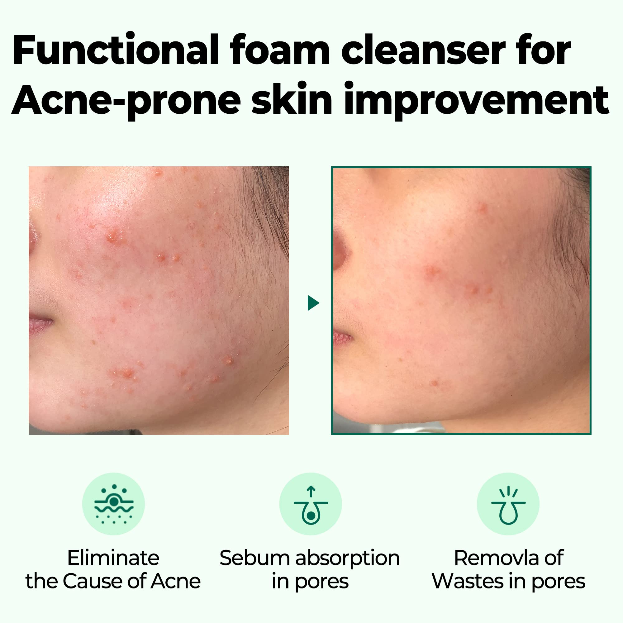 AHA BHA PHA 30 Days Miracle Foam