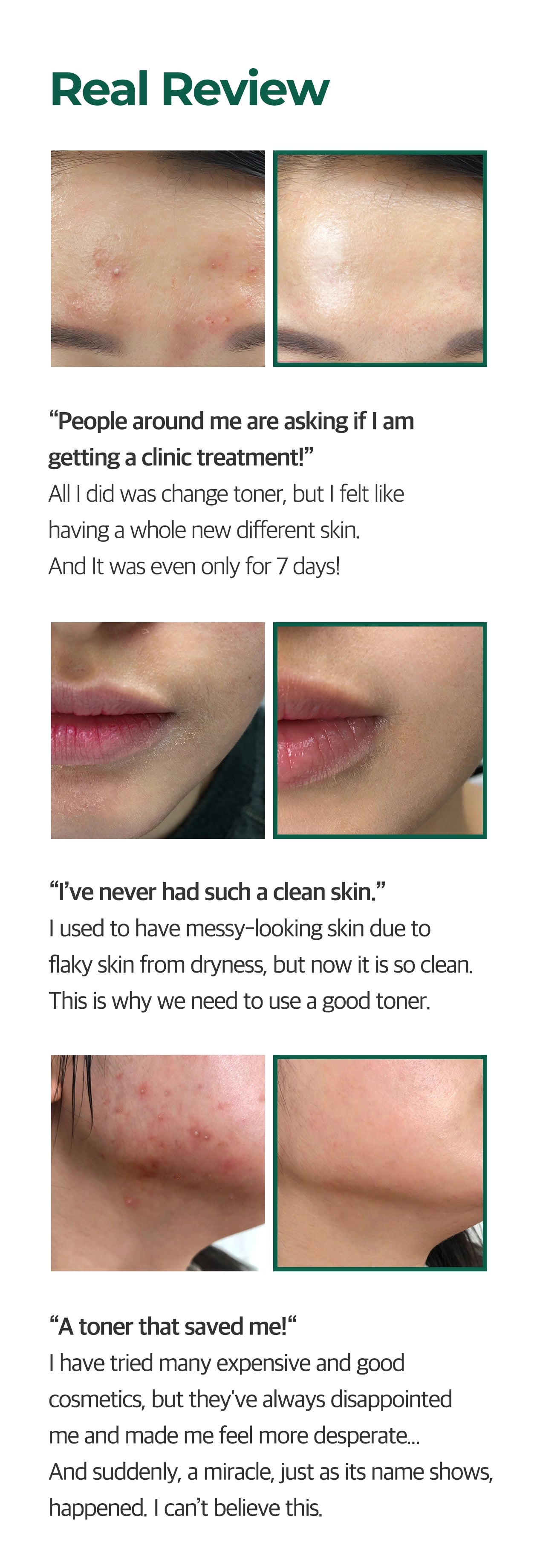 AHA BHA PHA 30 Days Miracle Toner