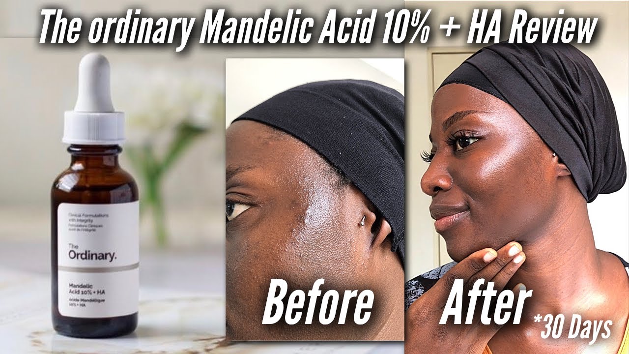 Mandelic Acid 10% + HA