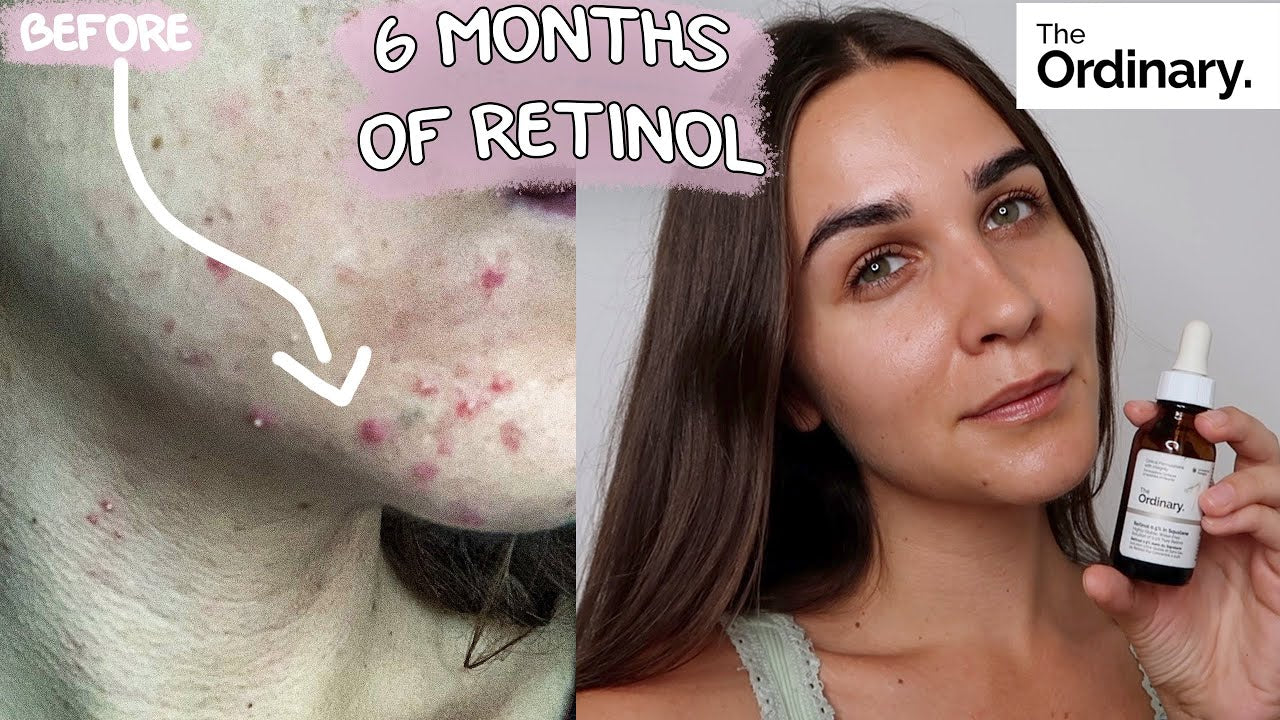 Retinol 0.5% in Squalane